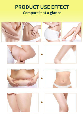 허브 추출물 및 에센서 체중 감량 허리 비누 지방 연소기 용 쿠르메크 인부스